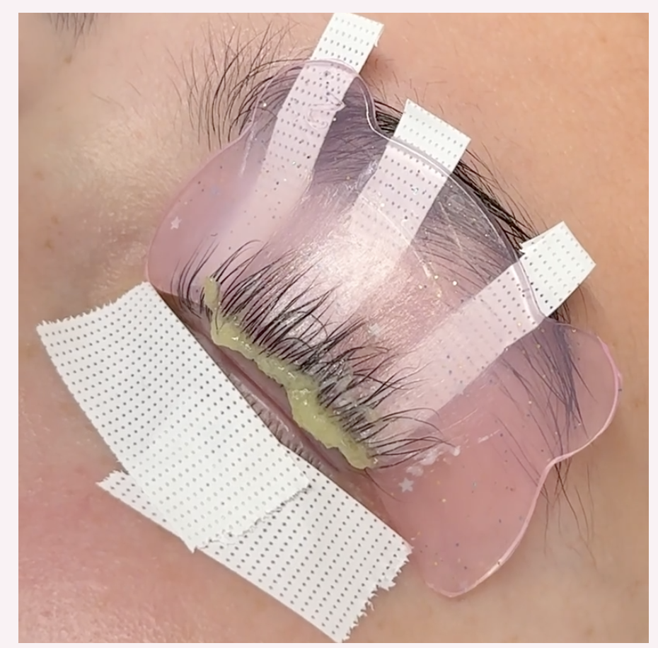 corrected coverage over the lash roots